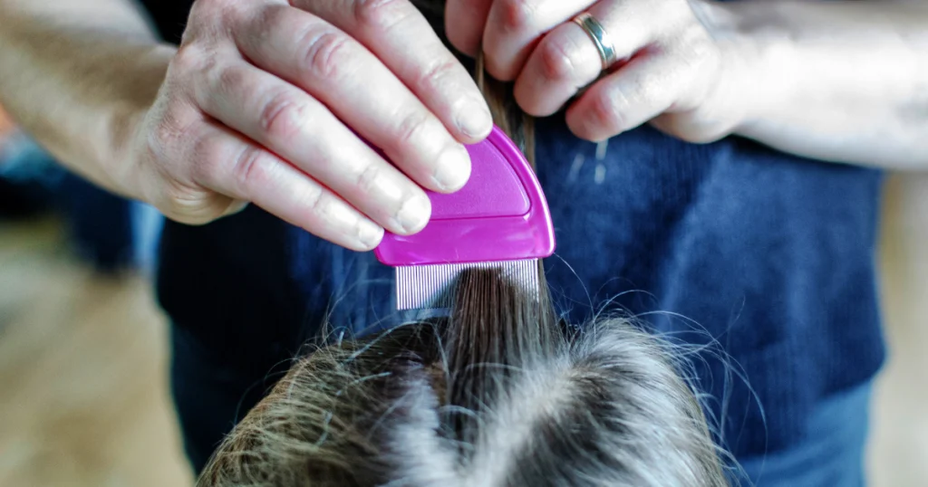 ¿Teñirse el pelo mata a los piojos?